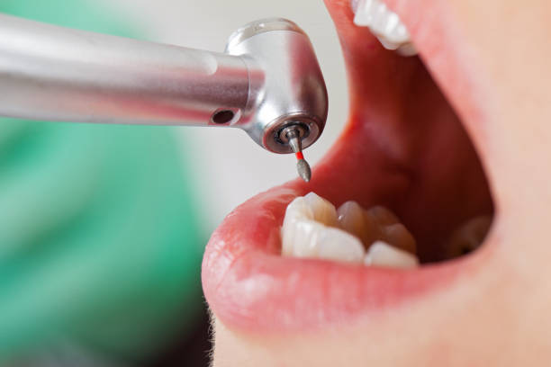 Best Same-Day Emergency Dental Services in Luverne, AL